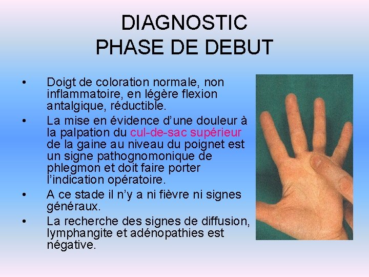 DIAGNOSTIC PHASE DE DEBUT • • Doigt de coloration normale, non inflammatoire, en légère