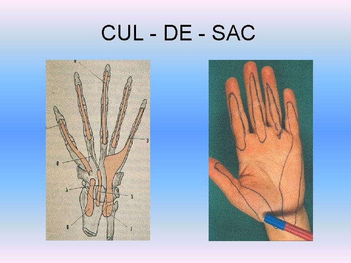  CUL - DE - SAC 
