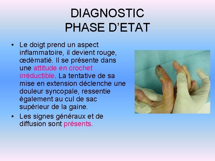 DIAGNOSTIC PHASE D’ETAT • Le doigt prend un aspect inflammatoire, il devient rouge, œdèmatié.