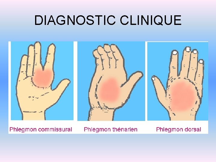 DIAGNOSTIC CLINIQUE 