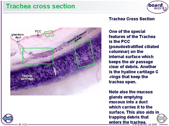 Trachea cross section Trachea Cross Section One of the special features of the Trachea