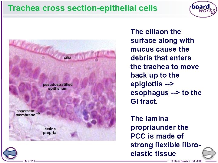 Trachea cross section-epithelial cells The ciliaon the surface along with mucus cause the debris