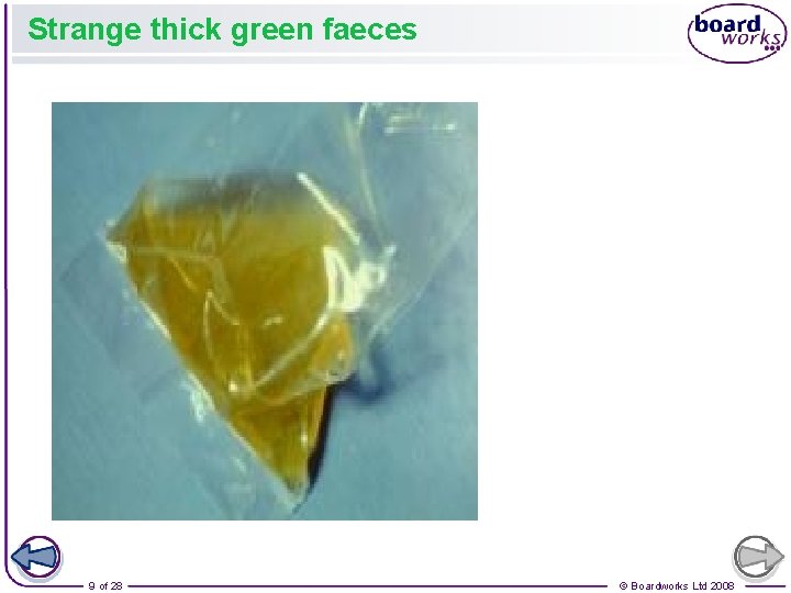 Strange thick green faeces 9 of 28 © Boardworks Ltd 2008 