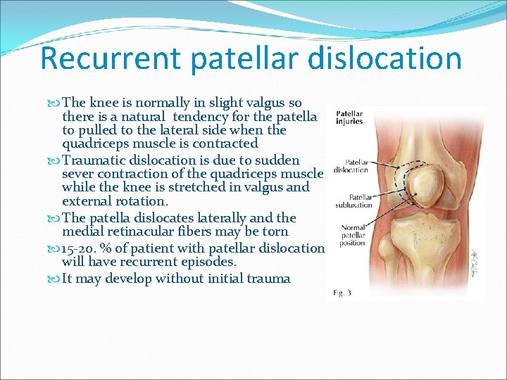 Recurrent patellar dislocation The knee is normally in slight valgus so there is a