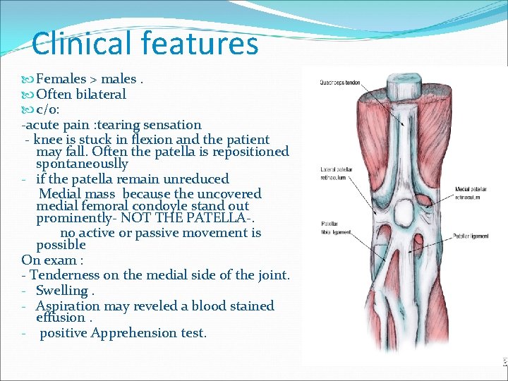 Clinical features Females > males. Often bilateral c/o: -acute pain : tearing sensation -
