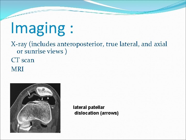 Imaging : X-ray (includes anteroposterior, true lateral, and axial or sunrise views ) CT