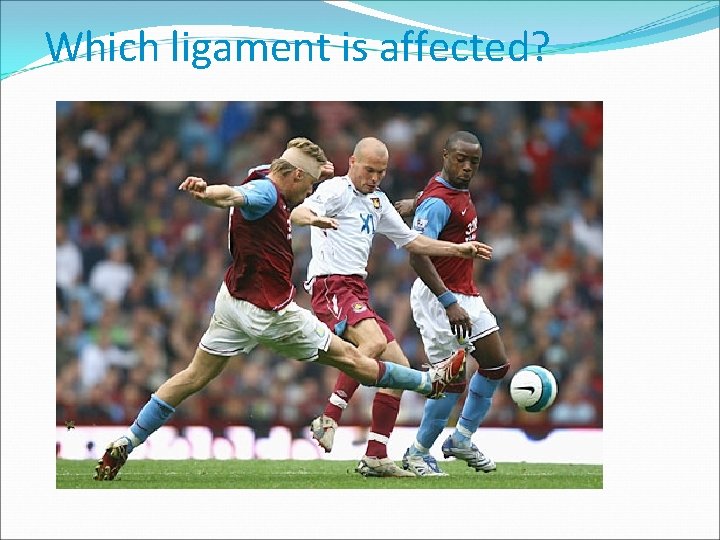 Which ligament is affected? 