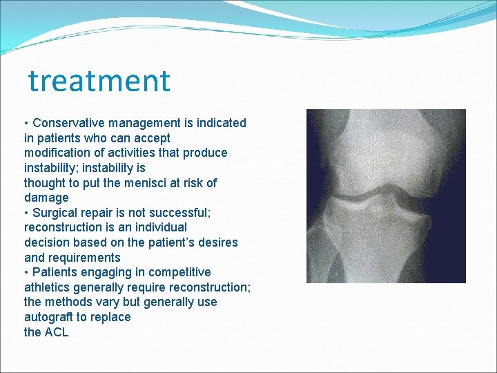 treatment • Conservative management is indicated in patients who can accept modification of activities