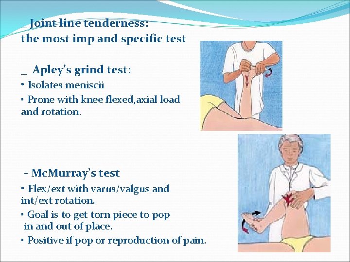 _ Joint line tenderness: the most imp and specific test _ Apley’s grind test: