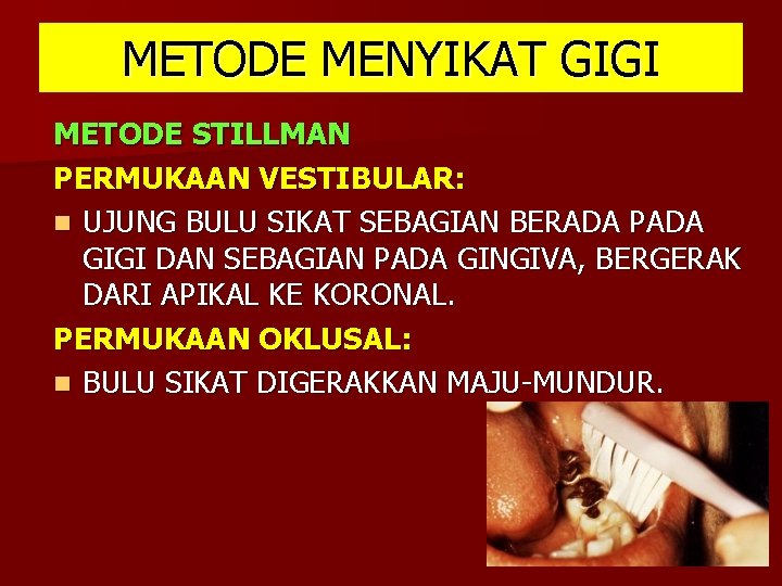 METODE MENYIKAT GIGI METODE STILLMAN PERMUKAAN VESTIBULAR: n UJUNG BULU SIKAT SEBAGIAN BERADA PADA METODE MENYIKAT GIGI METODE STILLMAN PERMUKAAN VESTIBULAR: n UJUNG BULU SIKAT SEBAGIAN BERADA PADA