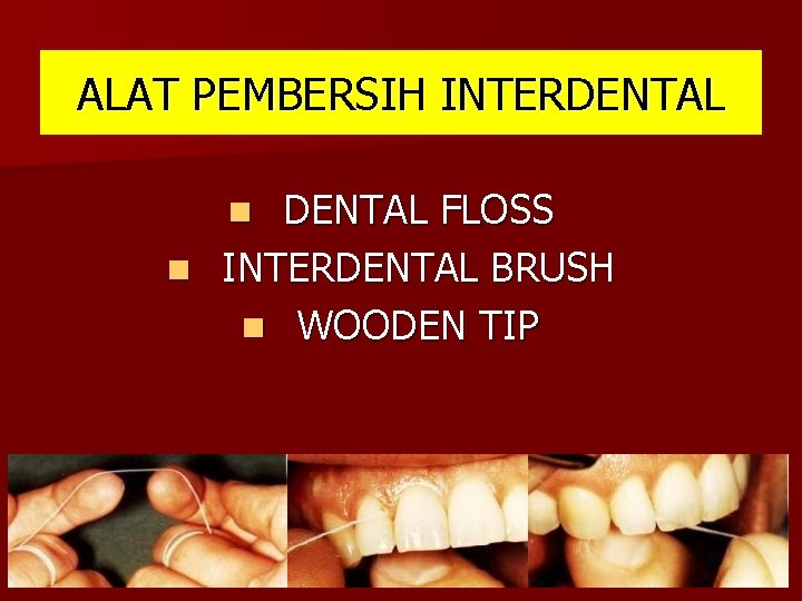 ALAT PEMBERSIH INTERDENTAL FLOSS n INTERDENTAL BRUSH n WOODEN TIP n 