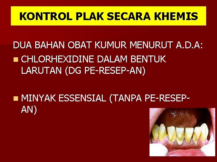 KONTROL PLAK SECARA KHEMIS DUA BAHAN OBAT KUMUR MENURUT A. D. A: n CHLORHEXIDINE