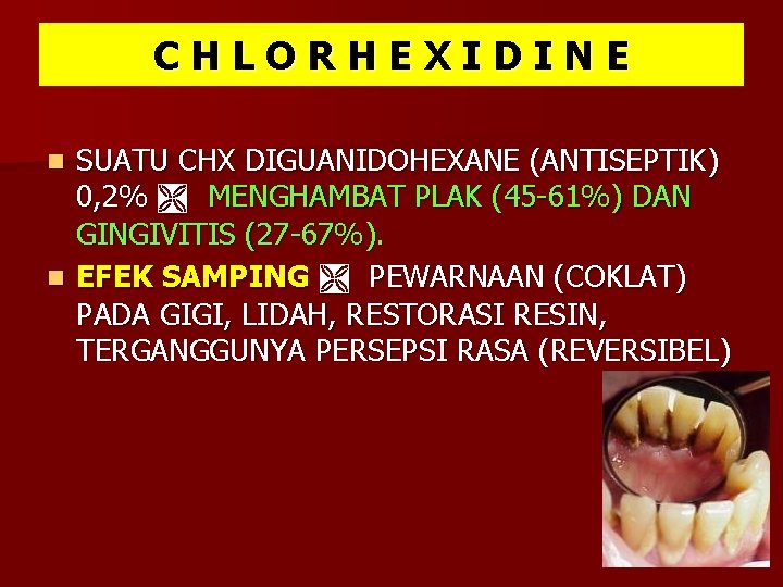 CHLORHEXIDINE SUATU CHX DIGUANIDOHEXANE (ANTISEPTIK) 0, 2% MENGHAMBAT PLAK (45 -61%) DAN GINGIVITIS (27 CHLORHEXIDINE SUATU CHX DIGUANIDOHEXANE (ANTISEPTIK) 0, 2% MENGHAMBAT PLAK (45 -61%) DAN GINGIVITIS (27