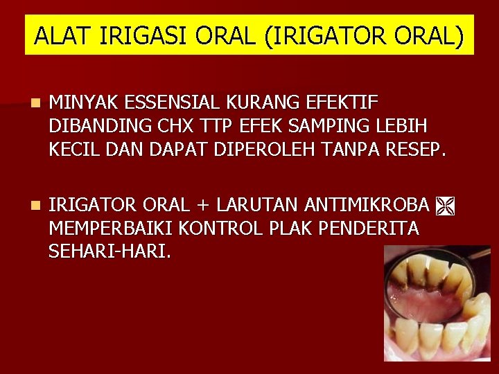 ALAT IRIGASI ORAL (IRIGATOR ORAL) n MINYAK ESSENSIAL KURANG EFEKTIF DIBANDING CHX TTP EFEK ALAT IRIGASI ORAL (IRIGATOR ORAL) n MINYAK ESSENSIAL KURANG EFEKTIF DIBANDING CHX TTP EFEK