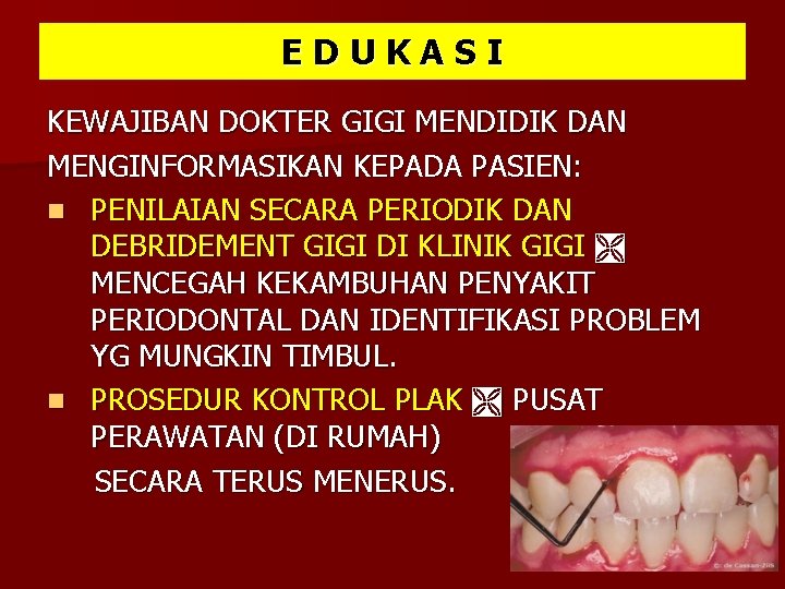 EDUKASI KEWAJIBAN DOKTER GIGI MENDIDIK DAN MENGINFORMASIKAN KEPADA PASIEN: n PENILAIAN SECARA PERIODIK DAN EDUKASI KEWAJIBAN DOKTER GIGI MENDIDIK DAN MENGINFORMASIKAN KEPADA PASIEN: n PENILAIAN SECARA PERIODIK DAN
