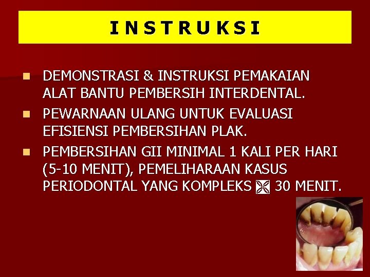 INSTRUKSI DEMONSTRASI & INSTRUKSI PEMAKAIAN ALAT BANTU PEMBERSIH INTERDENTAL. n PEWARNAAN ULANG UNTUK EVALUASI INSTRUKSI DEMONSTRASI & INSTRUKSI PEMAKAIAN ALAT BANTU PEMBERSIH INTERDENTAL. n PEWARNAAN ULANG UNTUK EVALUASI