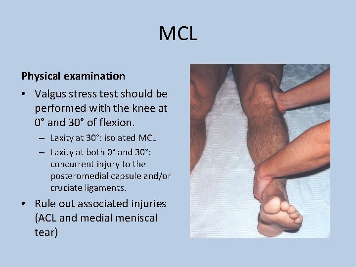 MCL Physical examination • Valgus stress test should be performed with the knee at