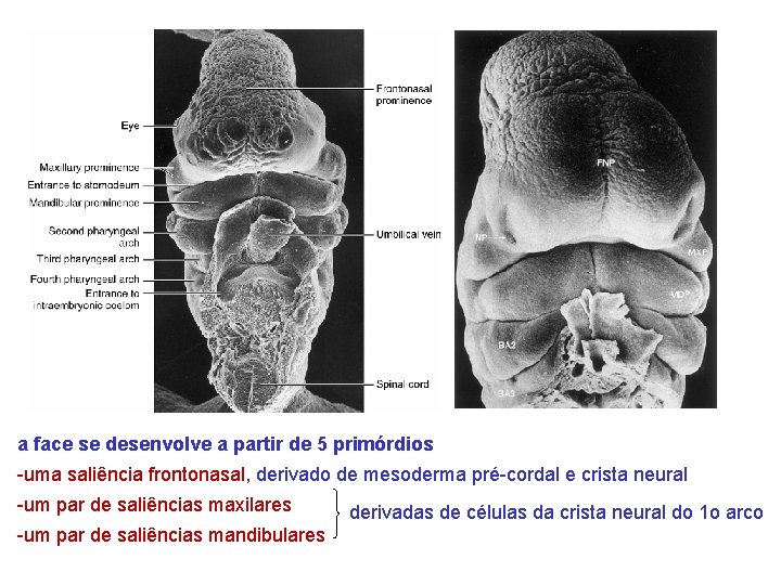 a face se desenvolve a partir de 5 primórdios -uma saliência frontonasal, derivado de