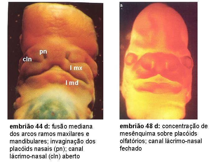 pn cln I mx I md embrião 44 d: fusão mediana dos arcos ramos