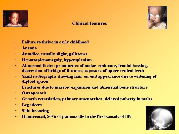 Clinical features • • • Failure to thrive in early childhood Anemia Jaundice, usually