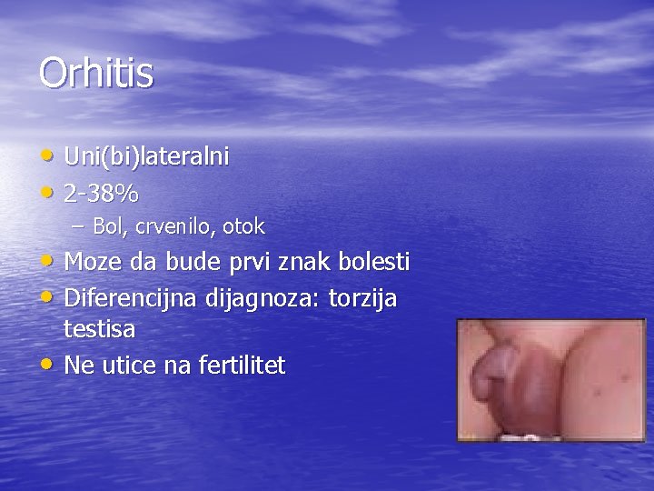 Orhitis • Uni(bi)lateralni • 2 -38% – Bol, crvenilo, otok • Moze da bude
