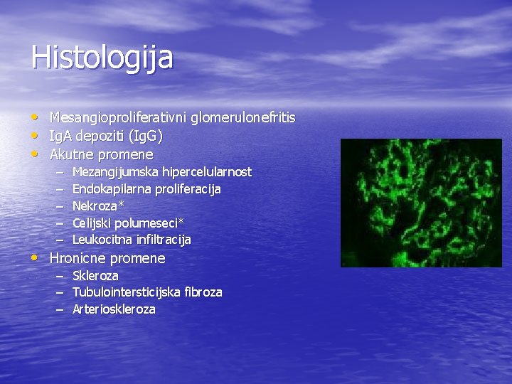 Histologija • • • Mesangioproliferativni glomerulonefritis Ig. A depoziti (Ig. G) Akutne promene –