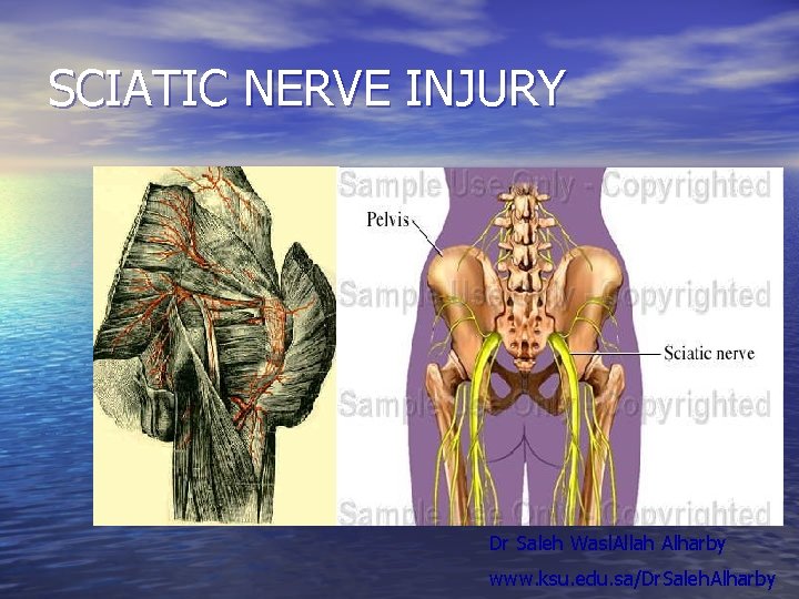 SCIATIC NERVE INJURY Dr Saleh Wasl. Allah Alharby www. ksu. edu. sa/Dr. Saleh. Alharby SCIATIC NERVE INJURY Dr Saleh Wasl. Allah Alharby www. ksu. edu. sa/Dr. Saleh. Alharby