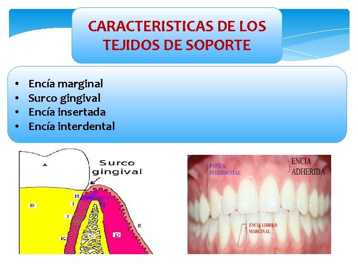 CARACTERISTICAS DE LOS TEJIDOS DE SOPORTE • • Encía marginal Surco gingival Encía insertada