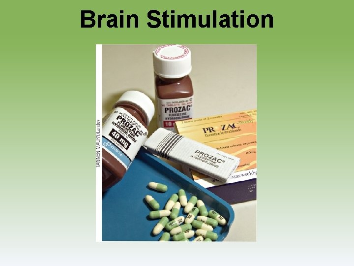 Brain Stimulation 