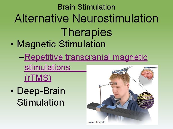 Brain Stimulation Alternative Neurostimulation Therapies • Magnetic Stimulation – Repetitive transcranial magnetic stimulations (r.