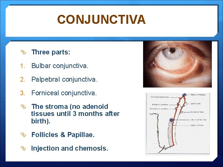 CONJUNCTIVA Three parts: 1. Bulbar conjunctiva. 2. Palpebral conjunctiva. 3. Forniceal conjunctiva. The stroma