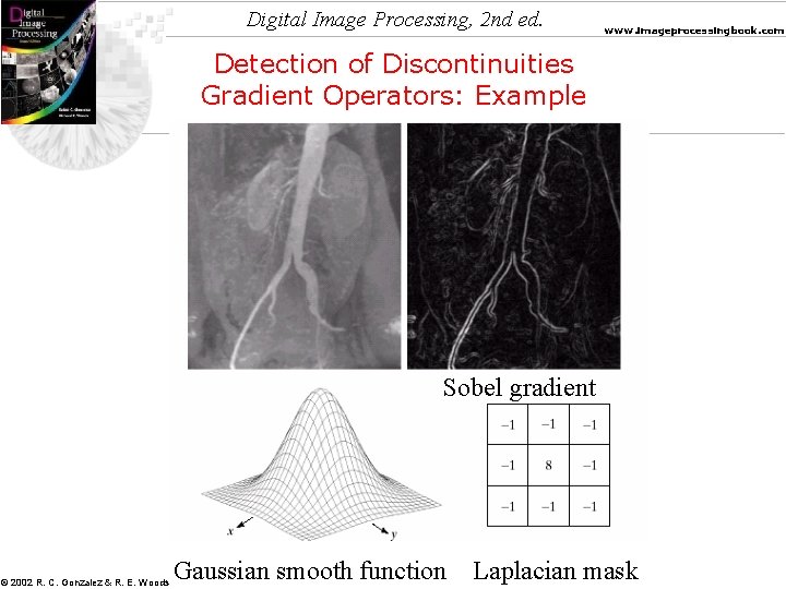 Digital Image Processing, 2 nd ed. www. imageprocessingbook. com Detection of Discontinuities Gradient Operators: