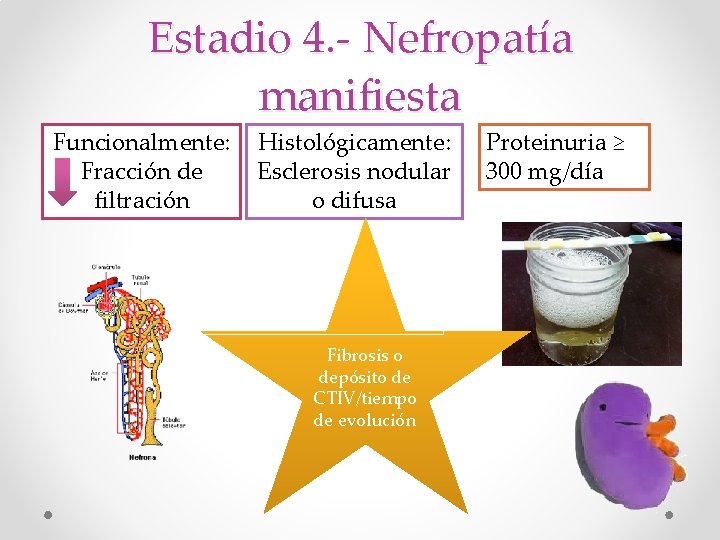 Estadio 4. - Nefropatía manifiesta Funcionalmente: Fracción de filtración Histológicamente: Esclerosis nodular o difusa