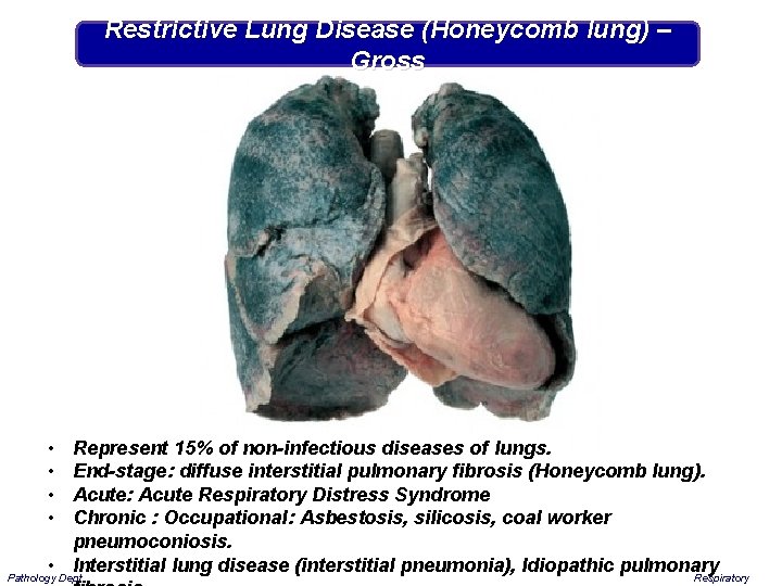 Restrictive Lung Disease (Honeycomb lung) – Gross • • Represent 15% of non-infectious diseases
