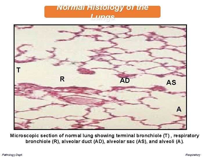 Normal Histology of the Lungs T R AD AS A Microscopic section of normal