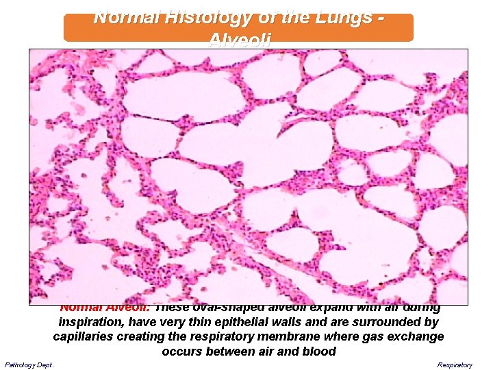 Normal Histology of the Lungs - Alveoli Normal Alveoli: These oval-shaped alveoli expand with