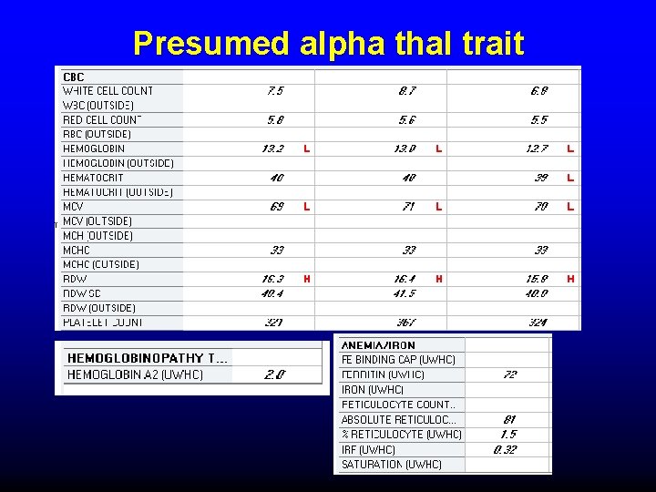 Presumed alpha thal trait 