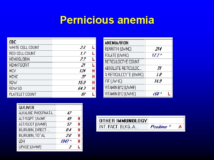 Pernicious anemia 