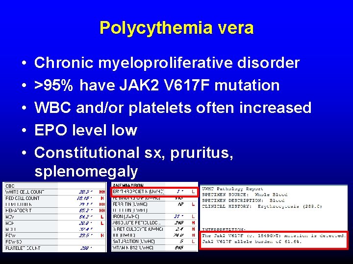 Polycythemia vera • • • Chronic myeloproliferative disorder >95% have JAK 2 V 617
