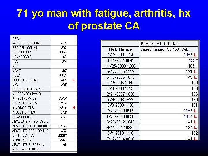 71 yo man with fatigue, arthritis, hx of prostate CA 