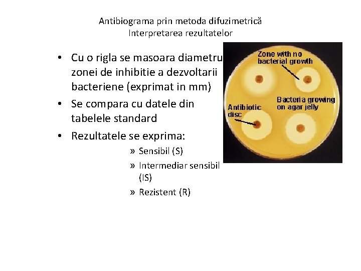 Antibiograma prin metoda difuzimetrică Interpretarea rezultatelor • Cu o rigla se masoara diametrul zonei