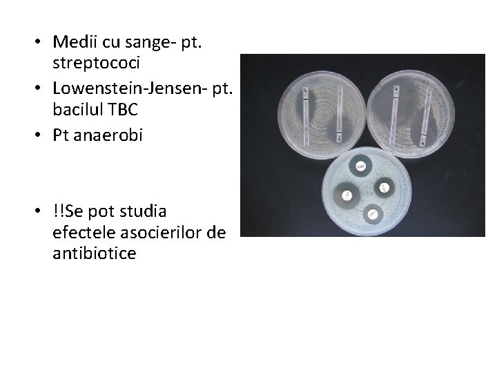  • Medii cu sange- pt. streptococi • Lowenstein-Jensen- pt. bacilul TBC • Pt
