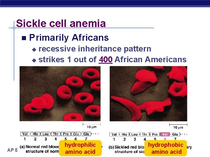 Sickle cell anemia n Primarily Africans recessive inheritance pattern u strikes 1 out of