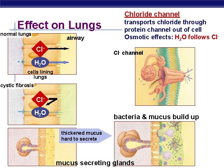 Chloride channel Effect on Lungs normal lungs airway Cl- transports chloride through protein channel