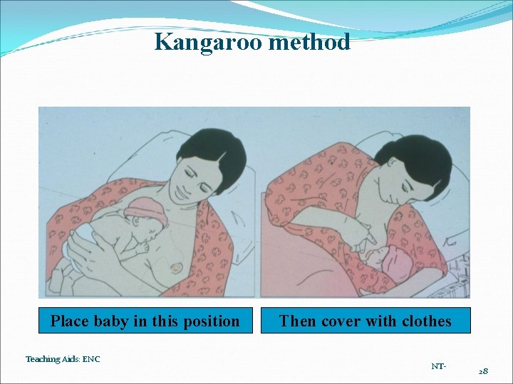 Kangaroo method Place baby in this position Teaching Aids: ENC Then cover with clothes Kangaroo method Place baby in this position Teaching Aids: ENC Then cover with clothes