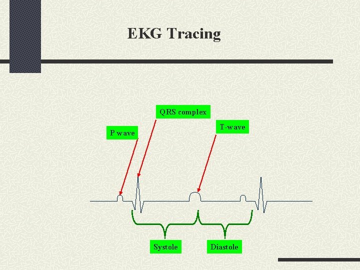 EKG Tracing QRS complex T-wave P wave Systole Diastole 