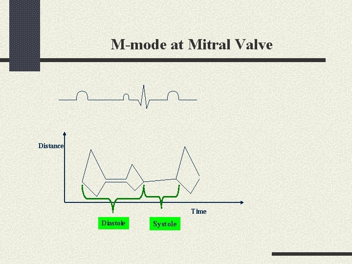 M-mode at Mitral Valve Distance Time Diastole Systole 