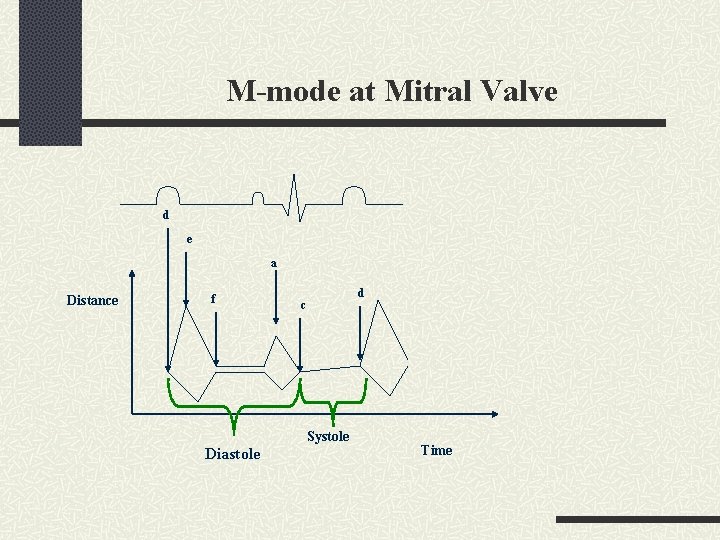 M-mode at Mitral Valve d e a Distance f d c Systole Diastole Time