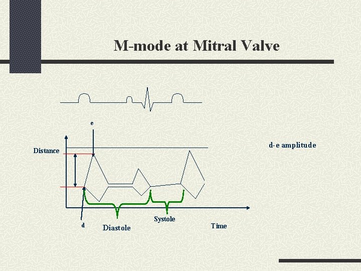 M-mode at Mitral Valve e d-e amplitude Distance d Systole Diastole Time 