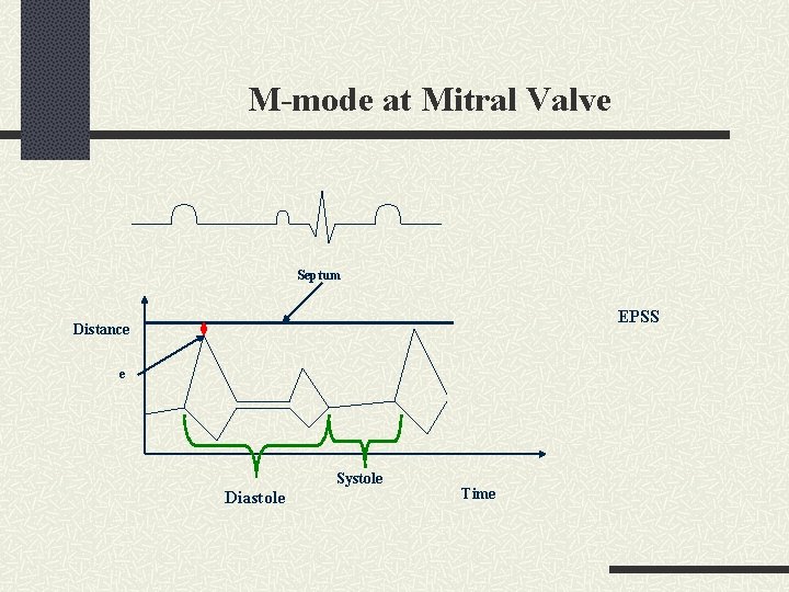 M-mode at Mitral Valve Septum EPSS Distance e Systole Diastole Time 